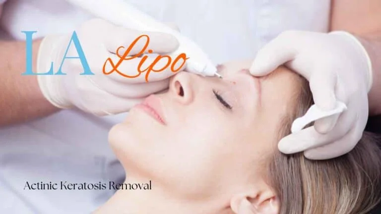 Woman receiving Actinic Keratosis Removal Treatment Broxbourne