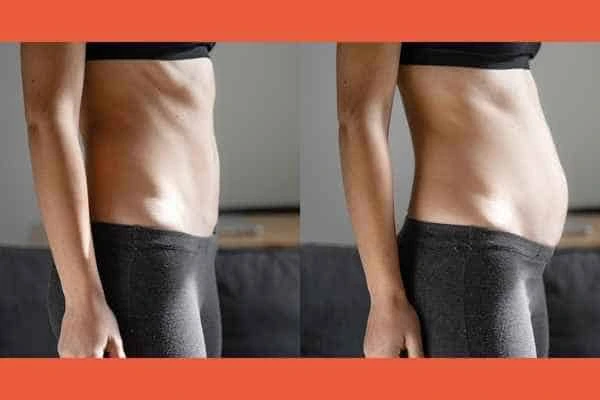LA-EMS Body Sculpting results Broxbourne
