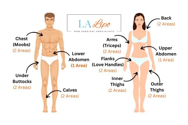 LA LIPO Cryolipolysis Areas Broxbourne
