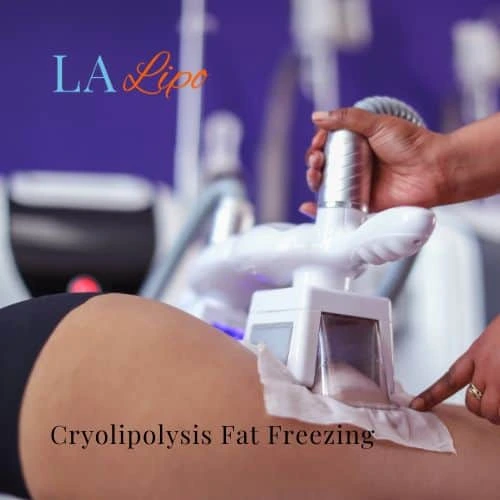 fat freezing - Cryolipolysis Broxbourne