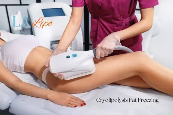Woman receiving coolsculpting Broxbourne treatment on her thighs
