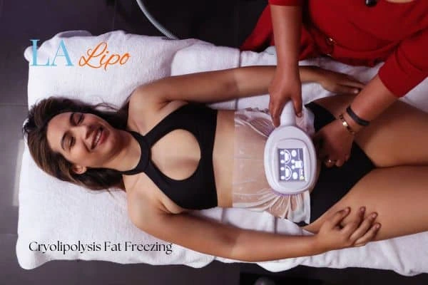 woman getting cryolipolysis Broxbourne