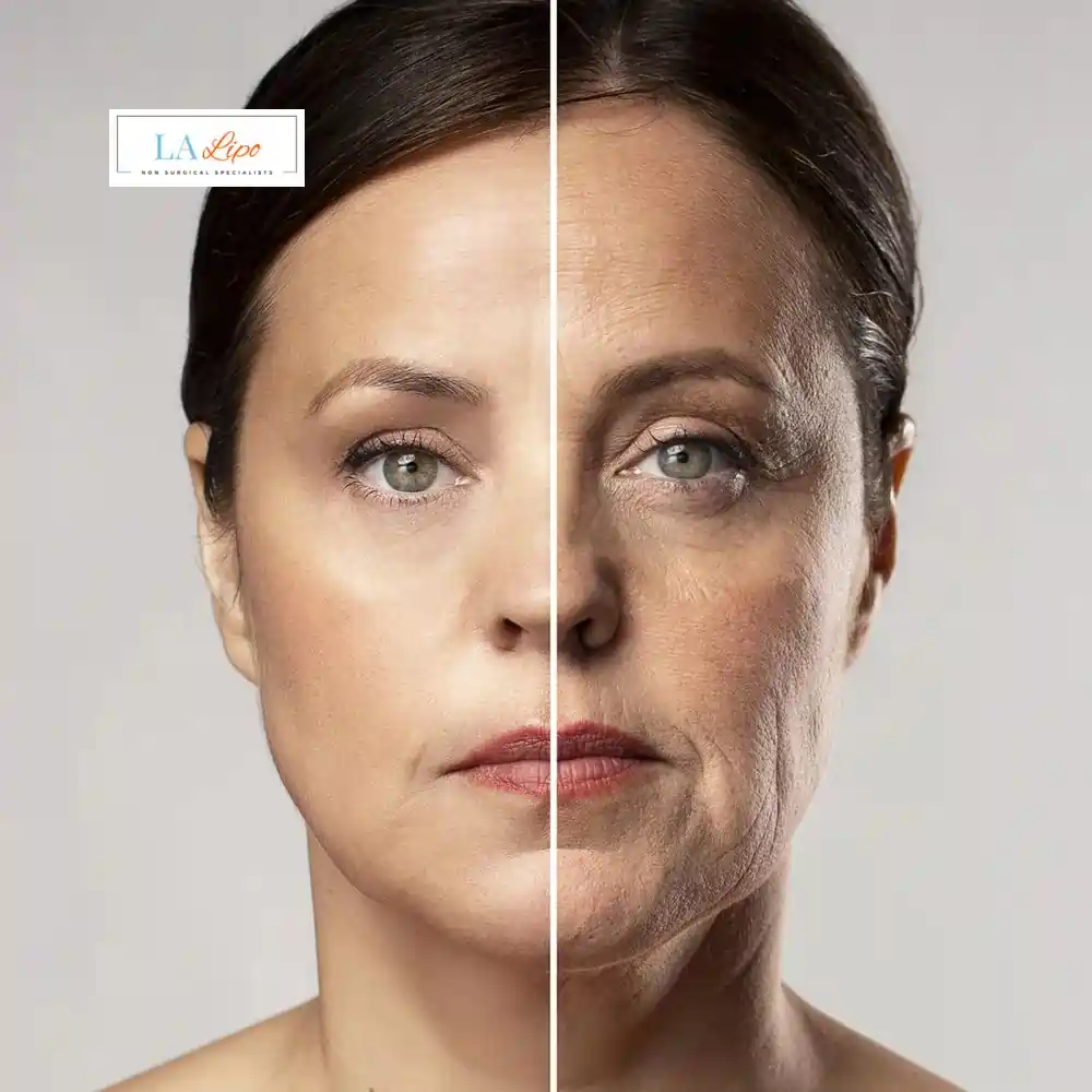 How Can You Tell If Non-Surgical Skin Tightening Is Right for You Broxbourne?