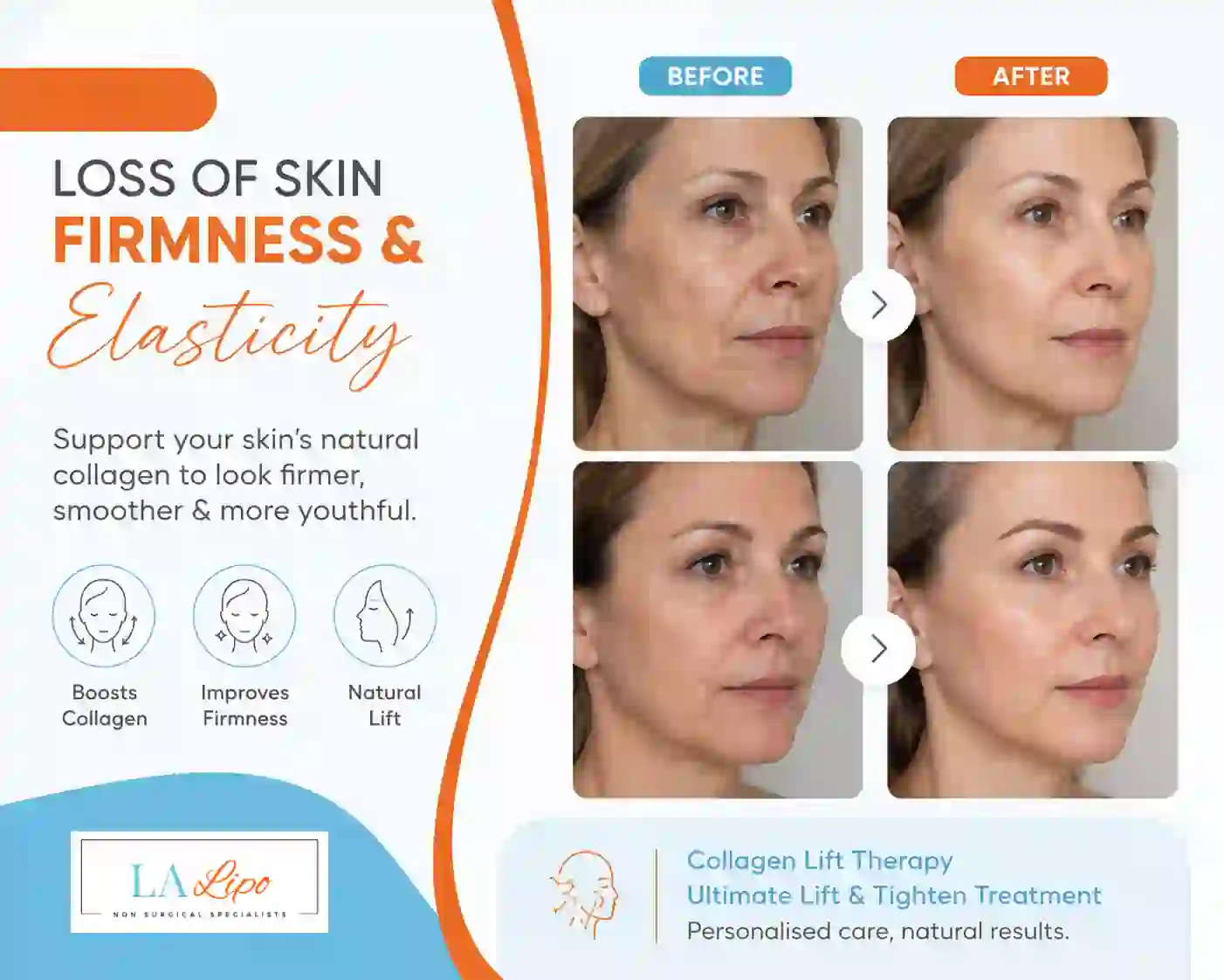 Sign #7: Loss of Skin Firmness and Elasticity Broxbourne